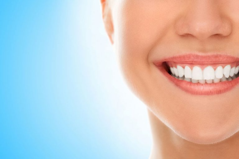 Por que substituir um dente perdido para a saúde dos demais dentes